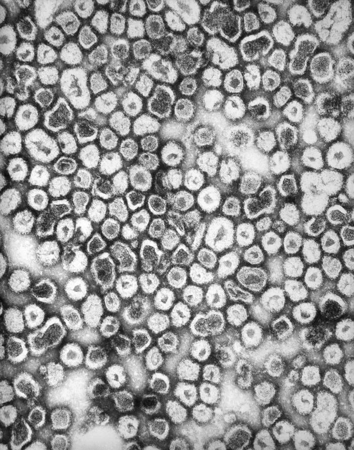 This negatively-stained transmission electron micrograph (TEM) revealed the presence of La Crosse encephalitis virus ribonucleoprotein particles (RNP). From Public Health Image Library (PHIL). [14]