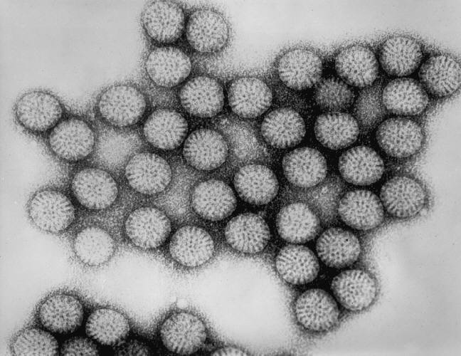 Intact double-shelled Rotavirus particles