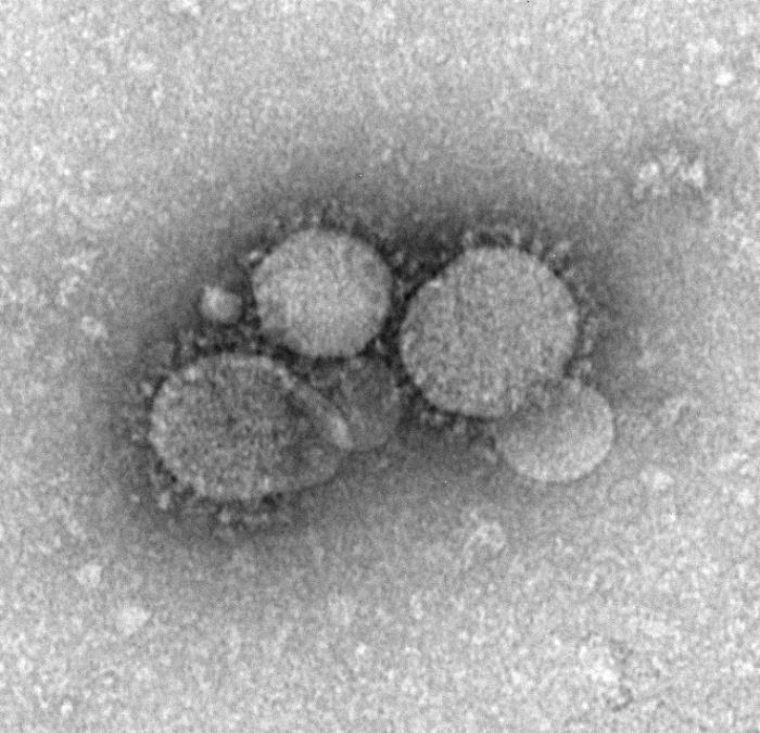 TEM reveals ultrastructural morphology of the Middle East Respiratory Syndrome Coronavirus (MERS-CoV). From Public Health Image Library (PHIL). [1]