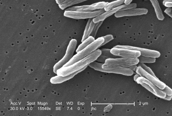 Scanning electron micrograph (SEM) of a number of Gram-positive Mycobacterium tuberculosis bacteria