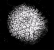 TEM micrograph of a herpes simplex virus.