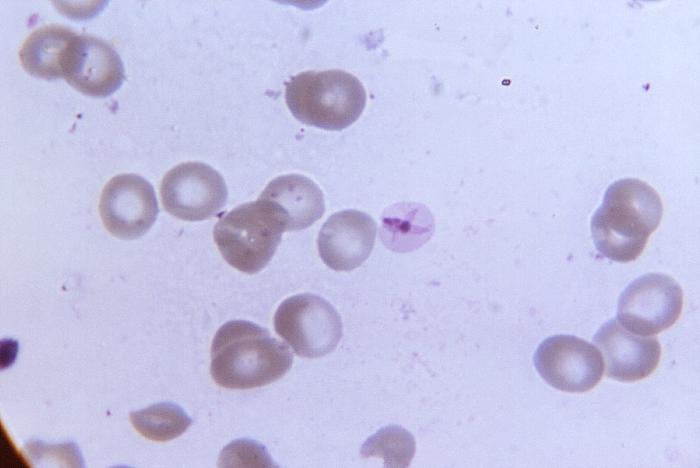 File:Malaria3.jpg