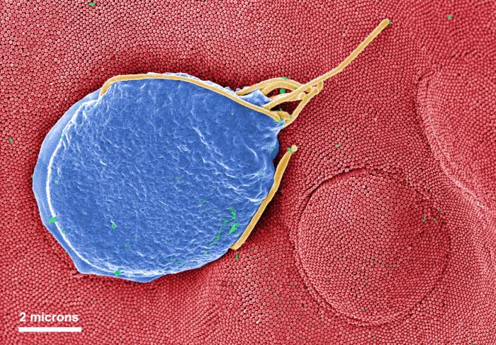 SEM depicts a Giardia muris protozoan adhering itself to the microvillous border of an intestinal epithelial cell. From Public Health Image Library (PHIL). [2]