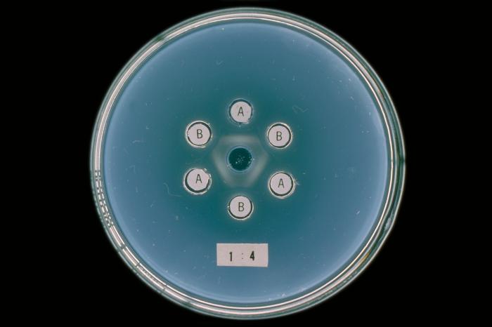 Actinomyces sp. From Public Health Image Library (PHIL). [1]