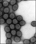 Electron micrograph of Rotaviruses.