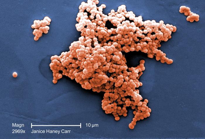 Scanning electron micrograph (SEM) revealed a cluster of Gram-positive, beta-hemolytic Group C Streptococcus sp. bacteria. From Public Health Image Library (PHIL). [1]