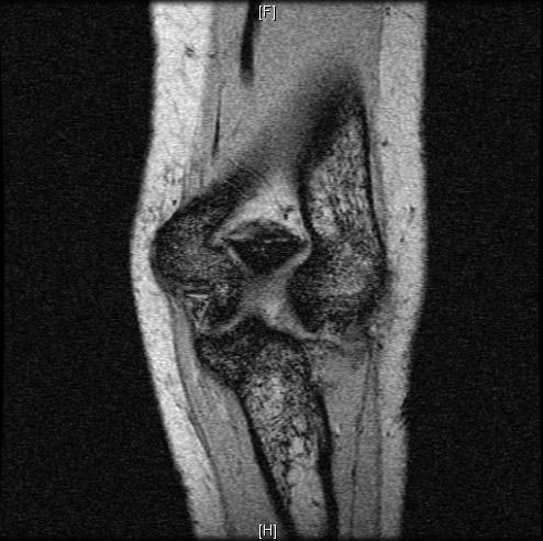 File:Normal-elbow-MRI-001.jpg