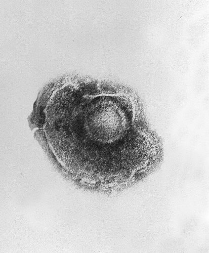 Transmission electron micrograph (TEM) of a Varicella (Chickenpox) Virus. From Public Health Image Library (PHIL). [2]