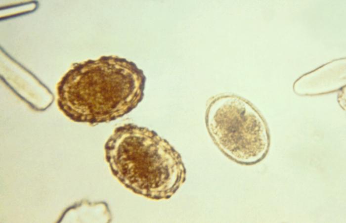 These are 3 fertilized A. lumbricoides eggs with the one on the right being decorticated, for its outer layer is absent. From Public Health Image Library (PHIL). [6]
