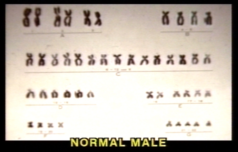 Karyotype of normal male.