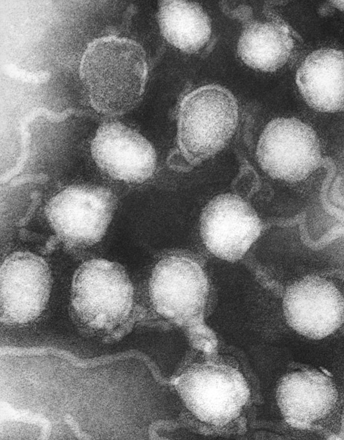 This negatively-stained transmission electron micrograph (TEM) revealed the presence of La Crosse encephalitis virus ribonucleoprotein particles (RNP). From Public Health Image Library (PHIL). [14]