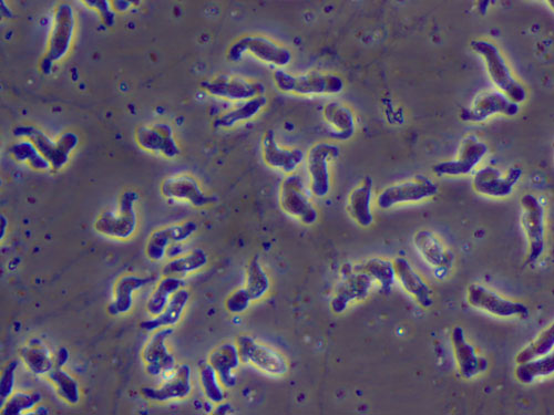 Naegleria fowleri trophozoites cultured from the CSF of a patient with acute PAM.