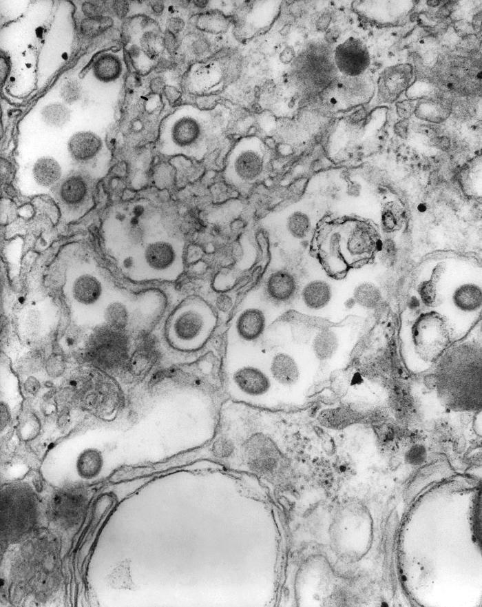 This transmission electron micrograph (TEM) revealed the presence of numerous Ganjam virus virions in this tissue specimen. This Bunyaviridae family member is antigenically, closely related to, and an Asian variant of, the Nairobi sheep disease virus (NSDV). From Public Health Image Library (PHIL). [1]