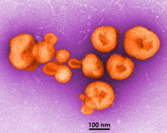 Arenavirus virions (transmission electron micrograph). Adapted from Public Health Image Library (PHIL). [1]