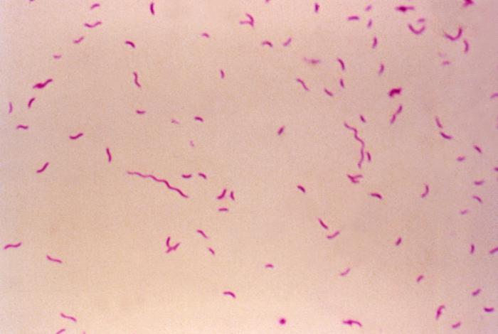 Gram-stained image shows the spiral rods of Campylobacter fetus subsp. fetus taken from an 18hr brain-heart infusion. From Public Health Image Library (PHIL). [1]