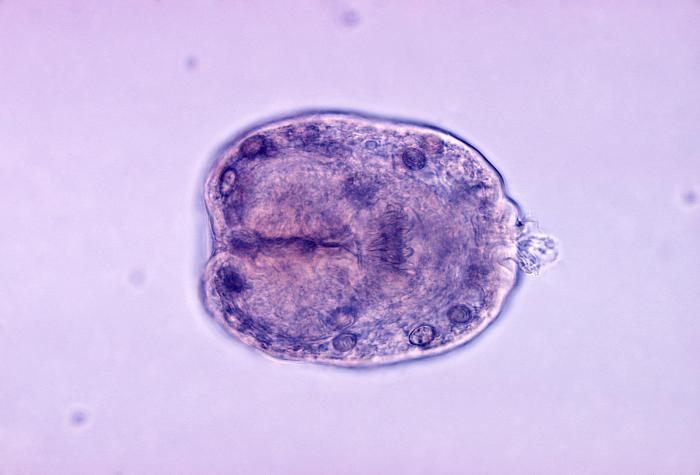 Scolex of Echinococcus granulosus from hydatid cyst. From Public Health Image Library (PHIL). [4]