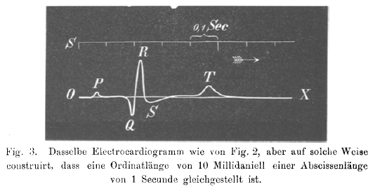 ECG from Einthoven's first publication. Pfügers Archiv March 1895, page 101-123