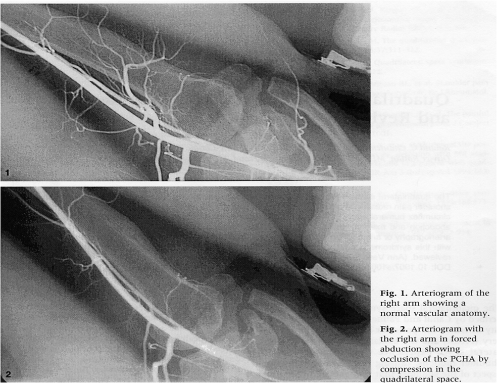 File:Angiography.png