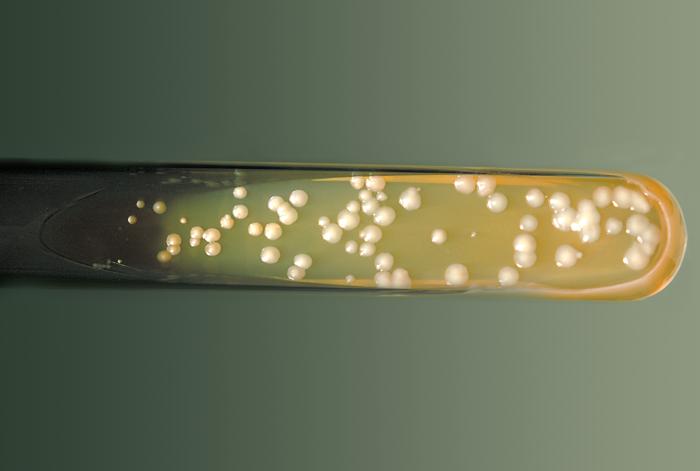 SABHI agar slant culture is growing Cryptococcus neoforman grown at 37°C. From Public Health Image Library (PHIL). [1]
