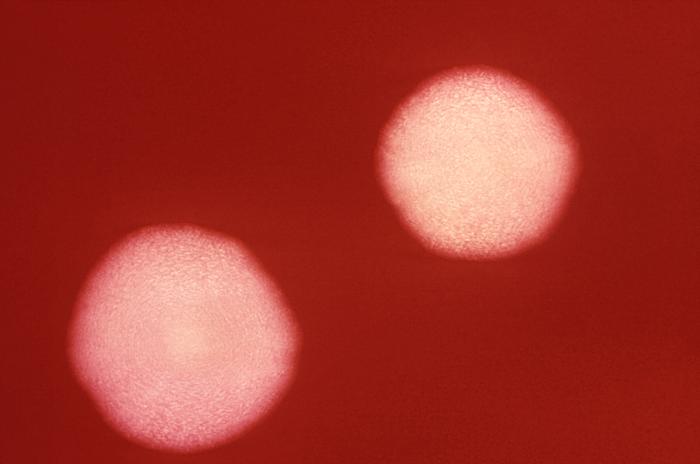 This 1972 photograph depicts two Bacteroides fragilis subsp. fragilis bacterial cultures grown on blood agar medium for 48 hours. From Public Health Image Library (PHIL). [7]