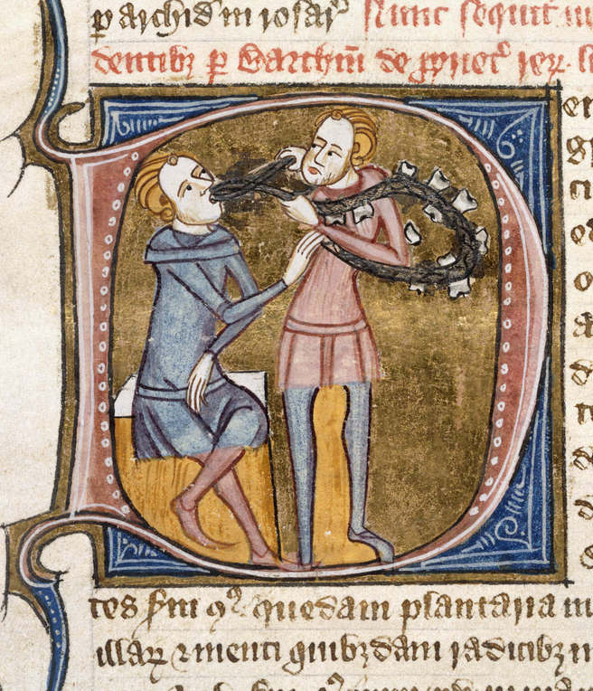 Medieval dentist extracting a tooth. London; c. 1360-75.