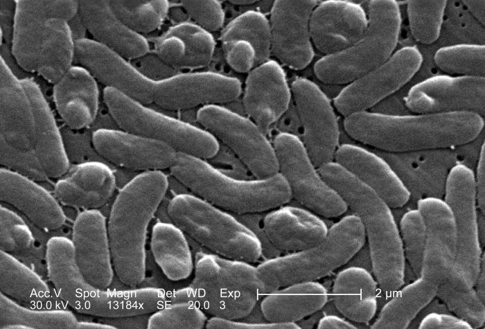 Scanning electron micrograph (SEM) depicts a grouping of Vibrio vulnificus bacteria; Mag. 13184x. From Public Health Image Library (PHIL). [2]