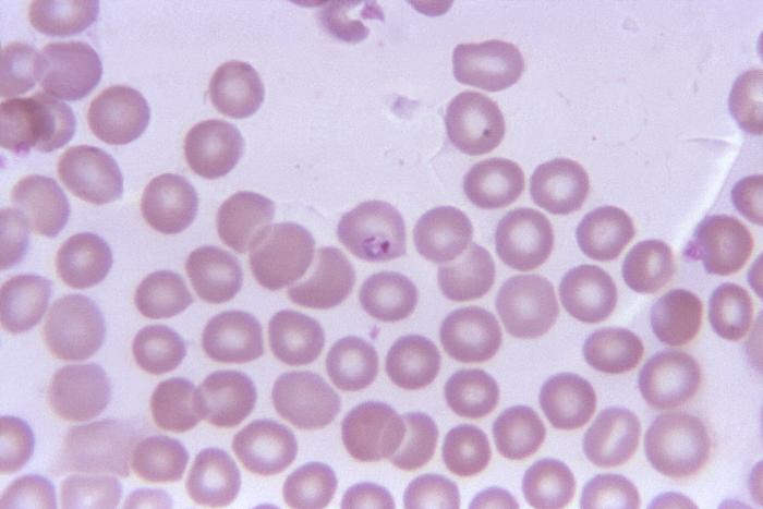 This photomicrograph revealed the presence of an "older ring-form" of a Babesia sp. protozoan parasite in a blood smear. This older ring-form was located within an erythrocyte, and was displaying two chromatin masses. From Public Health Image Library (PHIL). [2]