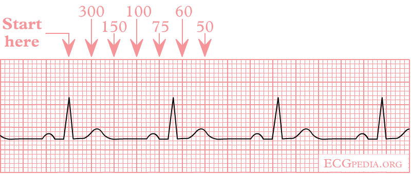 Calculation of the heart rate using the squares counting method
