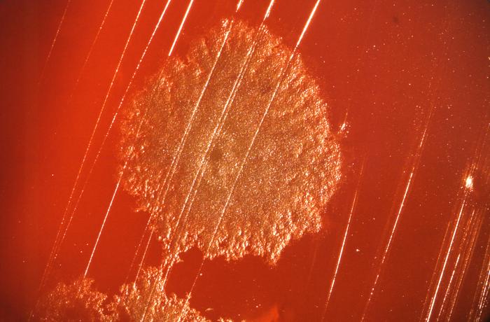 Clostridium sp. Gram-positive bacteria, which had been grown on a 4% blood agar plate (BAP) 48hrs. From Public Health Image Library (PHIL). [7]