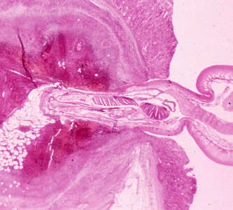 Cross-section of the intestine of a pig, stained with H&E, showing the anterior end of an adultMacracanthorhynchus hirudinaceous embedded within the intestinal wall. Adapted from CDC