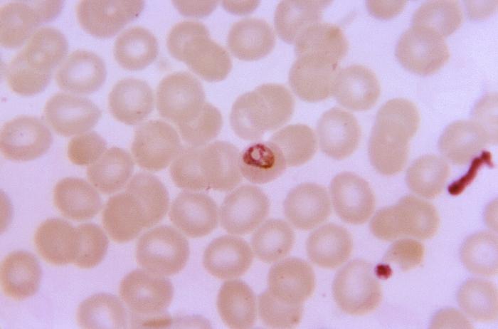 Thin film blood smear micrograph depicts a growing Plasmodium malariae trophozoite Adapted from Public Health Image Library (PHIL), Centers for Disease Control and Prevention.[6]