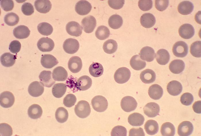 Babesia microti in blood smear. Giemsa stain. Parasite. From Public Health Image Library (PHIL). [2]
