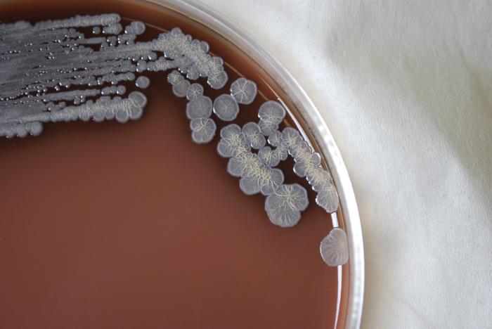 Gram-negative Burkholderia pseudomallei bacteria, grown on a medium of chocolate agar 72hrs. From Public Health Image Library (PHIL). [12]