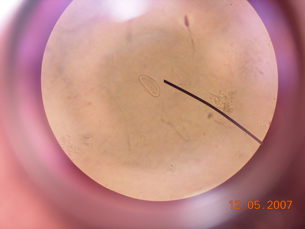 Enterobius vermicularis egg under a light microscope.