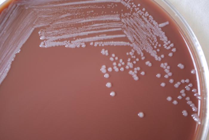Gram-negative Yersinia pestis bacteria, grown on chocolate agar 72hrs. From Public Health Image Library (PHIL). [6]