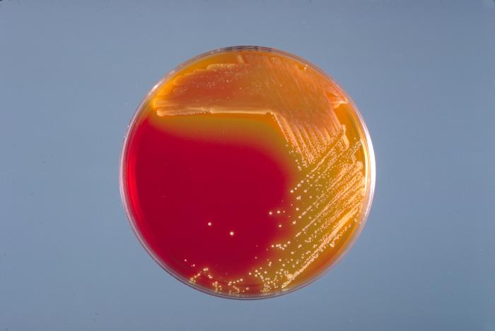 Xylose-lysine-deoxycholate (XLD) agar culture plate that had been inoculated with Enterobacter sakazakii 24hrs. From Public Health Image Library (PHIL). [7]