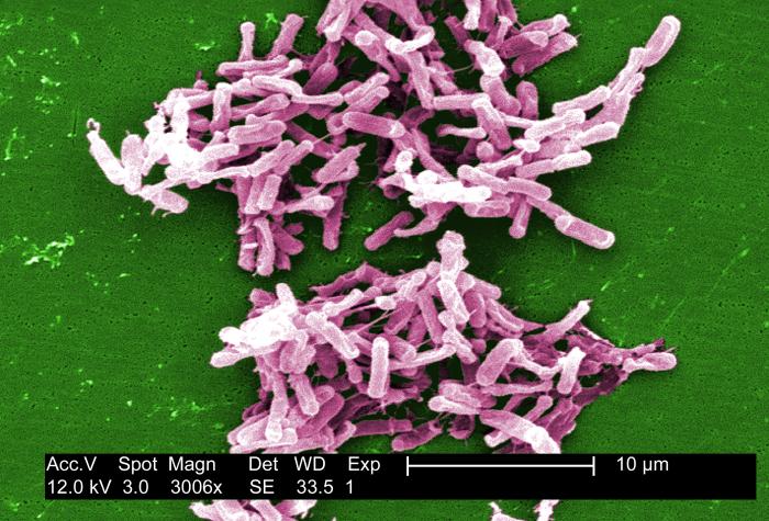 Gram-positive C. difficile bacteria from a stool sample culture obtained using a .1µm filter. From Public Health Image Library (PHIL). [15]