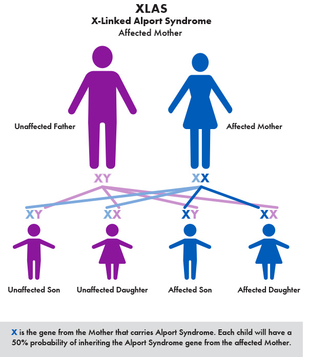 Alport Syndrome X-linked Mother.jpg