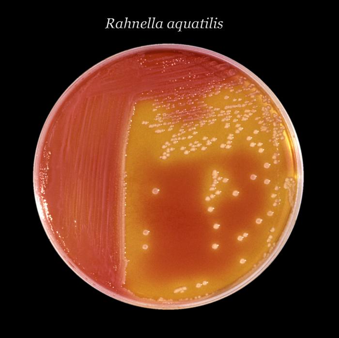 Xylose-lysine-deoxycholate (XLD) agar culture plate with Rahnella aquatilis bacteria (24hrs). From Public Health Image Library (PHIL). [1]