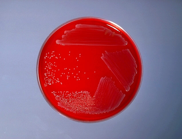 Blood agar plate culture of Corynebacterium diphtheriae mitis. From Public Health Image Library (PHIL). [2]