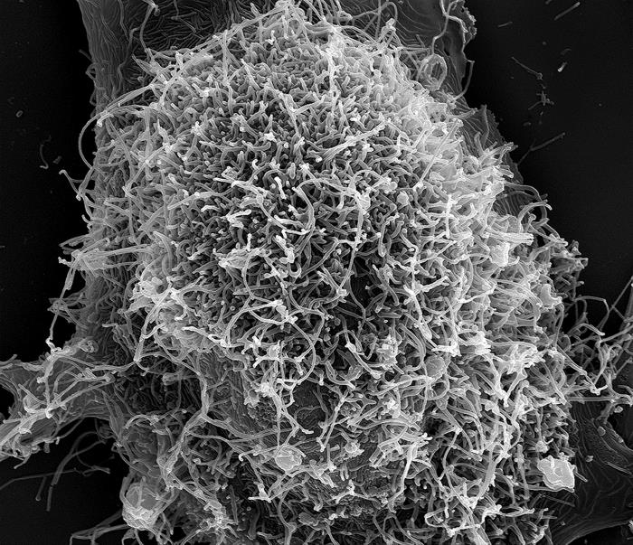 Produced by the National Institute of Allergy and Infectious Diseases (NIAID), under a magnification of 15,000X, this scanning electron photomicrograph (SEM) depicts numerous filamentous Ebola virus particles attached and budding from a chronically-infected VERO E6 cell. From Public Health Image Library (PHIL). [8]