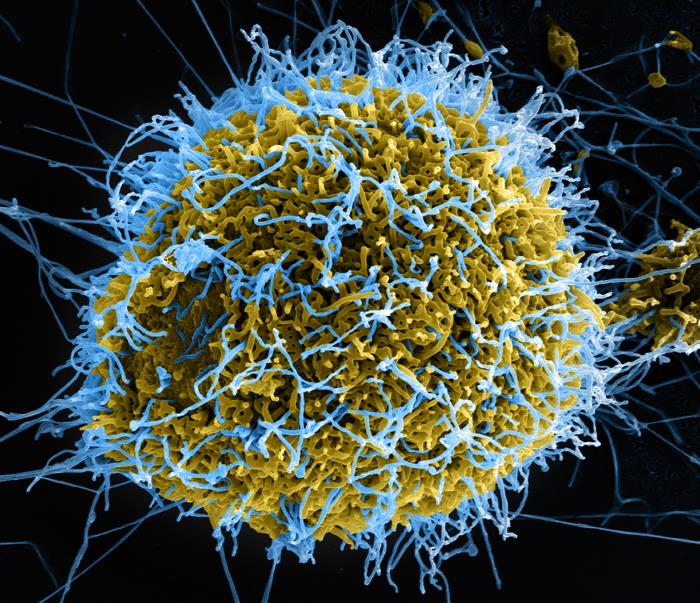 Produced by the National Institute of Allergy and Infectious Diseases (NIAID), this digitally-colorized scanning electron micrograph (SEM) depicts numerous filamentous Ebola virus particles (blue) budding from a chronically-infected VERO E6 cell (yellow-green). From Public Health Image Library (PHIL). [8]