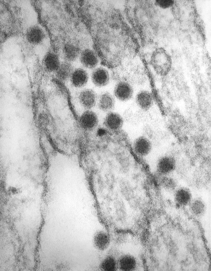 Transmission electron micrograph (TEM) reveals the presence of numerous St. Louis encephalitis virions that were contained within a tissue sample. From Public Health Image Library (PHIL). [2]