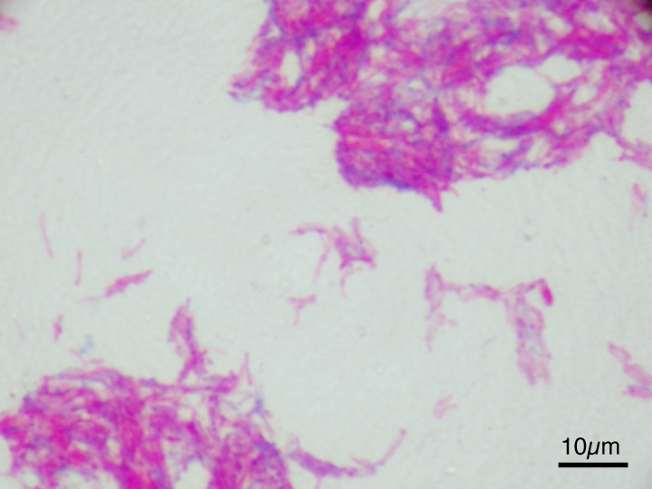 Attenuated strain of M. bovis used in the Bacillus Calmette-Guérin vaccine