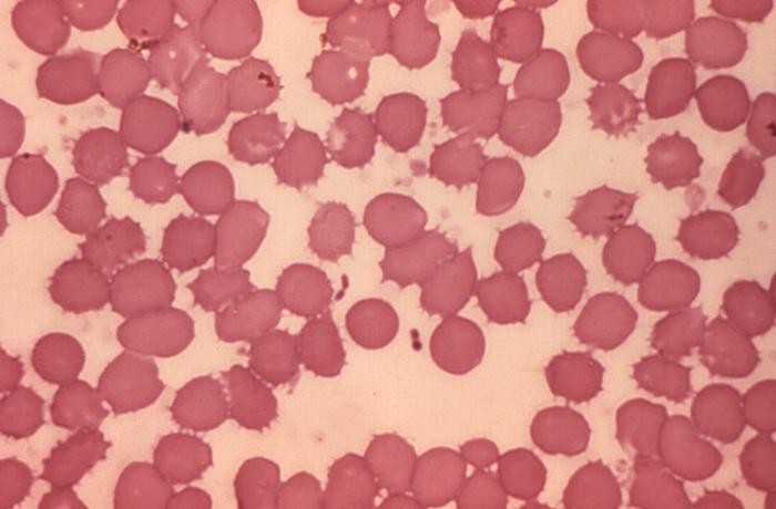 Blood smear reveals presence of Gram-negative Yersinia pestis plague bacteria. From Public Health Image Library (PHIL). [13]