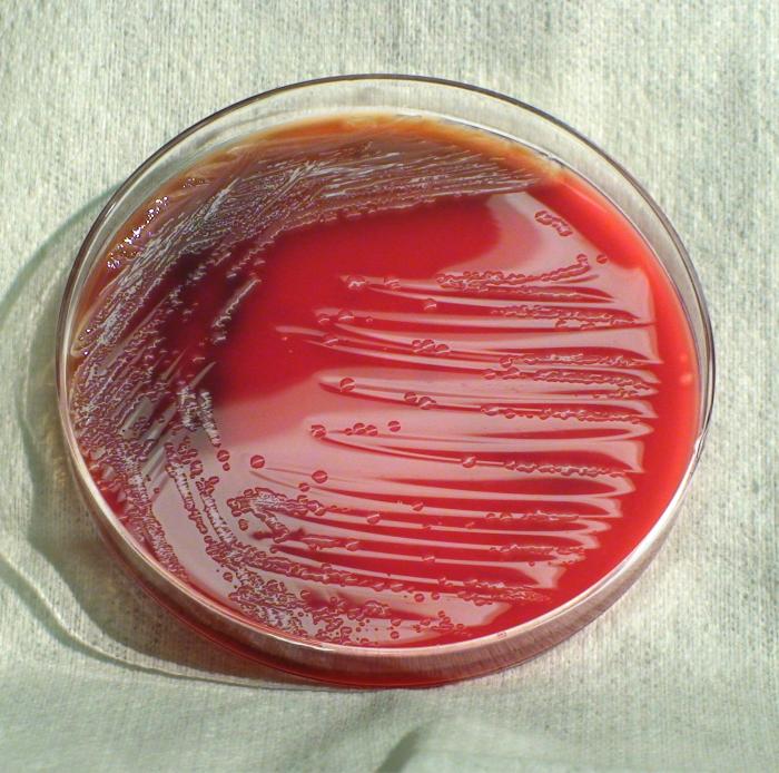 Gram-negative Shigella boydii bacteria grown on a medium of sheep’s blood agar (SBA) 24hrs. From Public Health Image Library (PHIL). [1]
