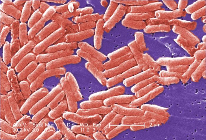 Gram-negative bacilli, or rod-shaped Salmonella sp. bacteria. From Public Health Image Library (PHIL). [4]