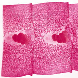 Carmine-stained proglottids of D. latum, showing the rosette-shaped ovaries.