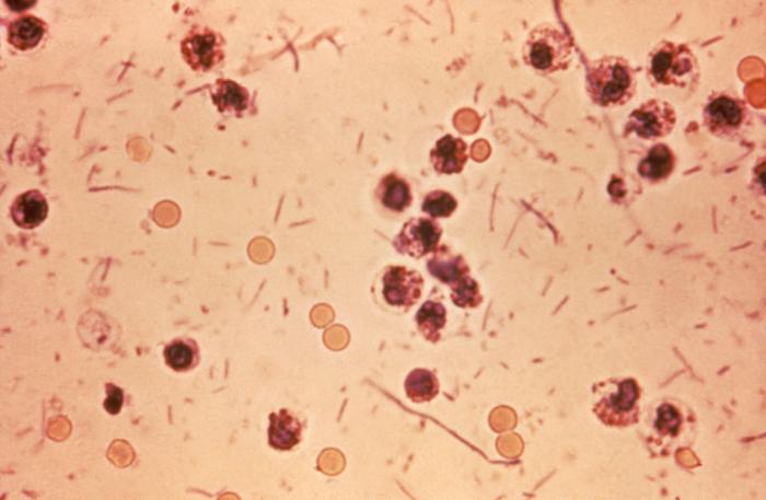 Photomicrograph of Shigella sp. in a stool specimen