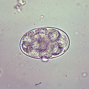 File:Oesophagostomum egg A.jpg